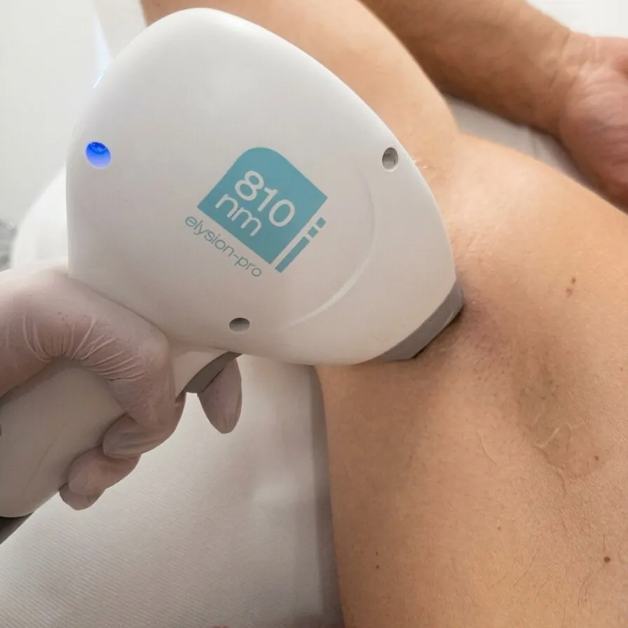 Diodenlaser-Behandlung